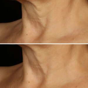 سمارت كلينيكال إصلاح كريم مصحح مضاد للتجاعيد 50مل - الصورة 4